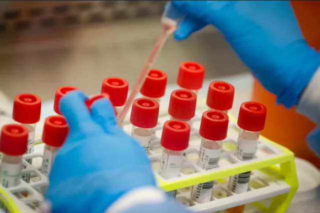 HV.1: A New COVID-19 Variant in the United States